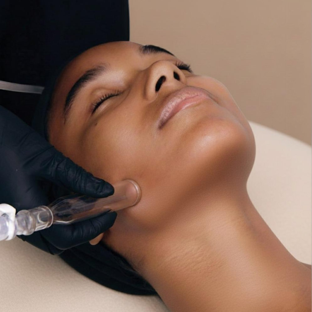 HydraFacial Platinum treatment